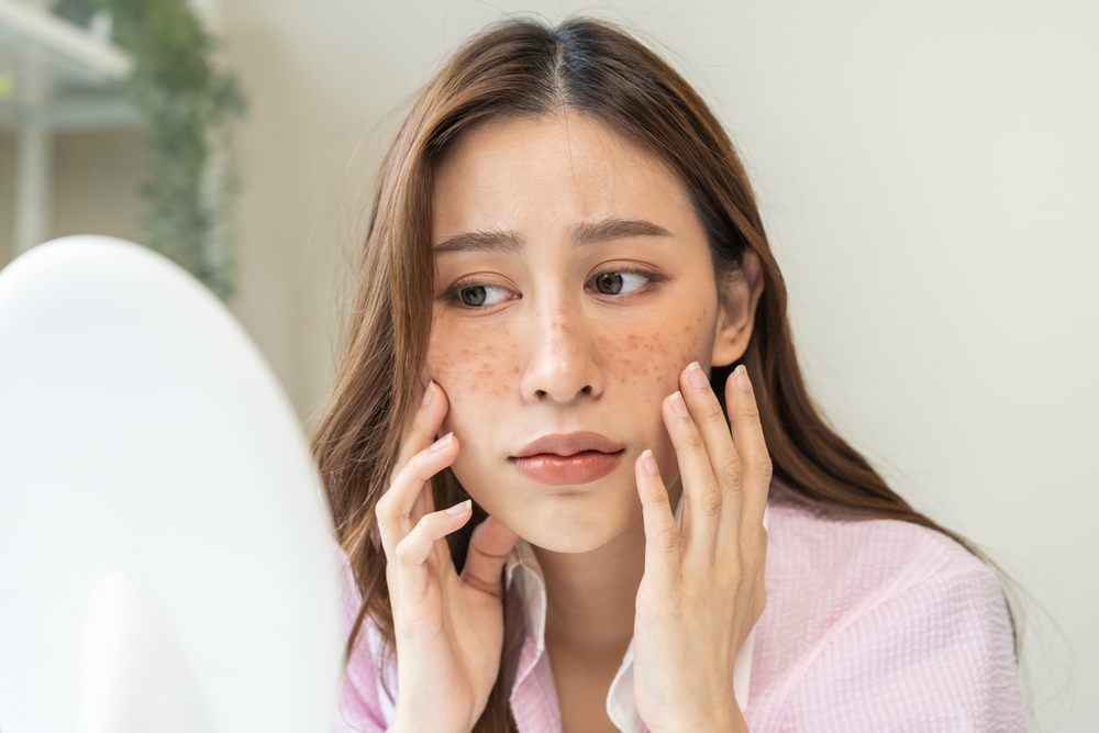Read more about the article Say Goodbye to Stubborn Spots With the Best Dark Spot Treatment in Bridgton, Maine