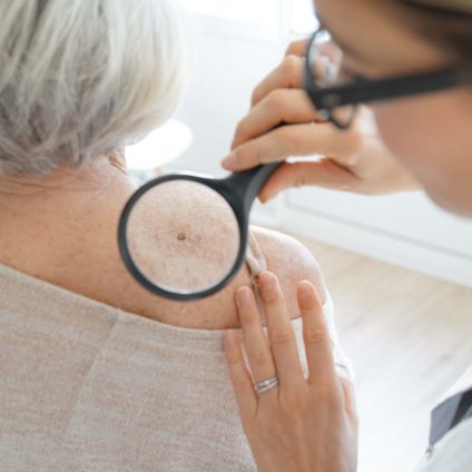 Senior woman getting skin checked by dermatologist Senior woman getting skin checked by dermatologist